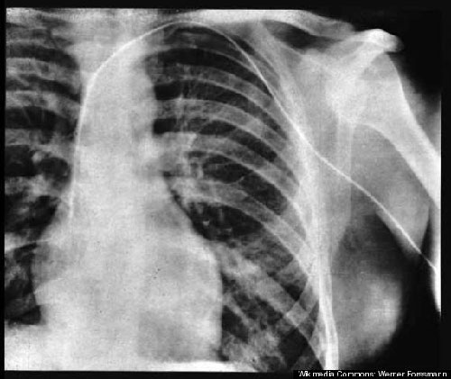 Picture 4 of Scientists forget about themselves because of research