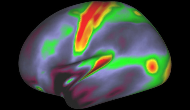 Picture 2 of Scientists have discovered 97 regions in the brain that have never been known before