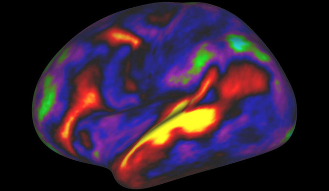 Picture 3 of Scientists have discovered 97 regions in the brain that have never been known before