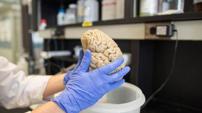 Picture 1 of Scientists have found a way to completely prevent brain cancer