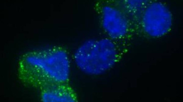 Picture 2 of Scientists have found a way to completely prevent brain cancer