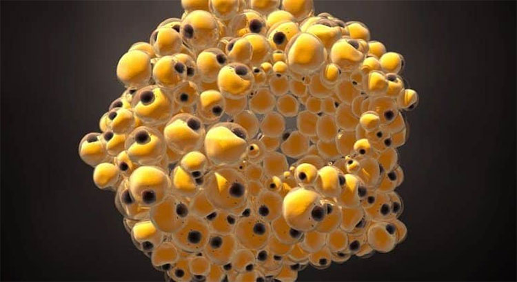 Picture 1 of Scientists have successfully turned breast cancer cells into ... fat