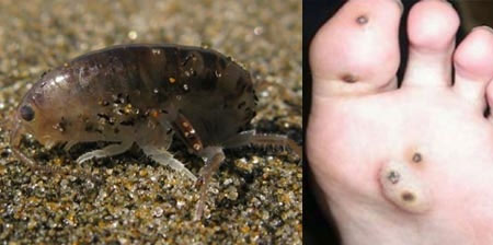 Picture 1 of Scientists raise parasites in the body
