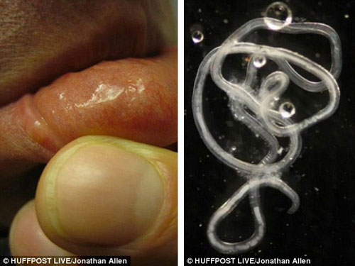 Picture 2 of Scientists raise parasites in the body