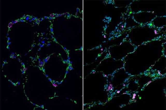 Picture 3 of Scientists successfully developed lung 'mini'