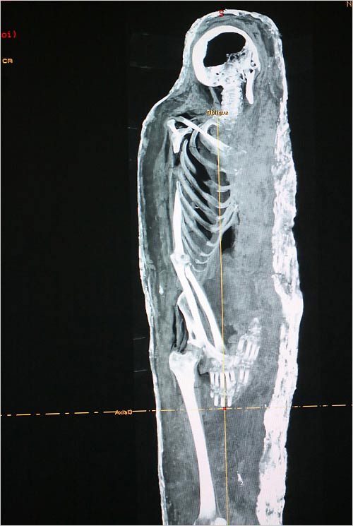 Picture 1 of Secret of a mummy