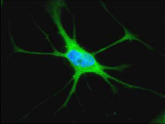 Picture 1 of Secrets in the brain of people who commit suicide because of depression