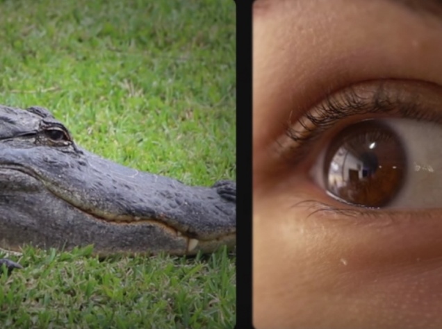 Picture 1 of See evolving evidence on your own body