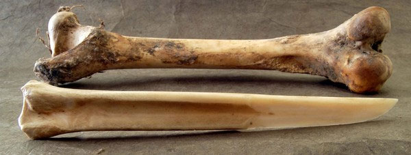 Picture 5 of See how experts identify identity of dead people