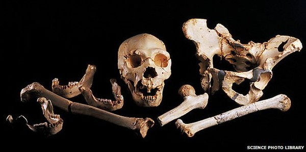 Picture 6 of See how experts identify identity of dead people