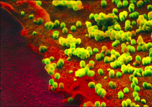 Picture 1 of See super antibodies against influenza A virus