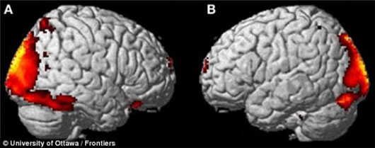 Picture 2 of See the brain when the soul leaves the body