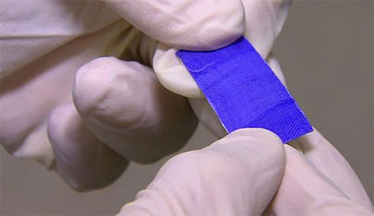 Picture 1 of Self-biodegradable stickers support the surgical process
