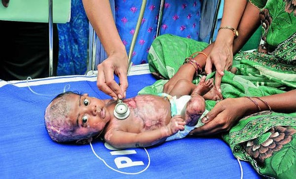 Picture 1 of Self-igniting bodies have no answers