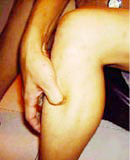 Picture 2 of Self-treat hemorrhoids with Oriental medicine