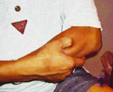Picture 3 of Self-treat hemorrhoids with Oriental medicine