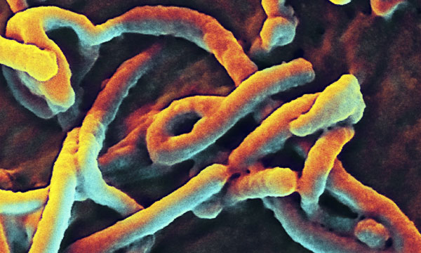 Picture 1 of Senegal confirmed the first case of Ebola infection was an international student