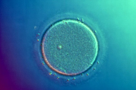 Picture 12 of Sexual history of humanity