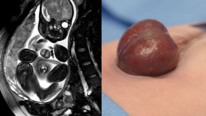 She was born with a heart outside her body images 2
