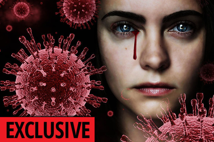 Picture 1 of Shock warning: The disease bleeds in the eyes of a Ebola pandemic