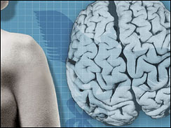 Picture 1 of Short limbs are related to the risk of dementia