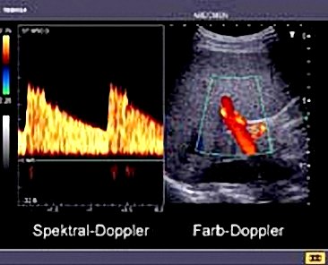 Picture 1 of Should make color or black and white ultrasound?