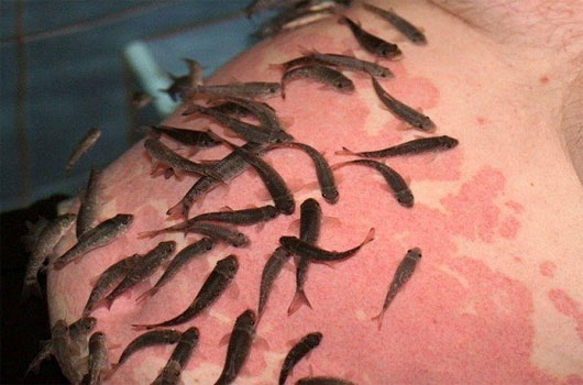 Picture 6 of Shudder with the healing methods 'taking poison poisoning'