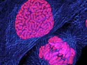 Picture 1 of Signs of ovarian cancer warning