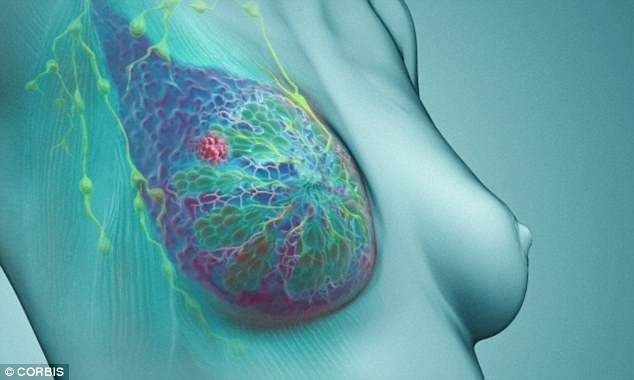 Picture 1 of Signs of some common types of cancer