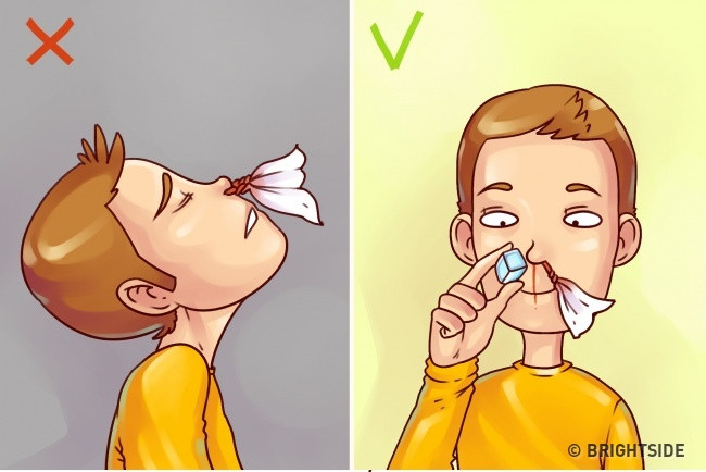 Picture 4 of Simple first aid tips but 90% of people make mistakes when urgent