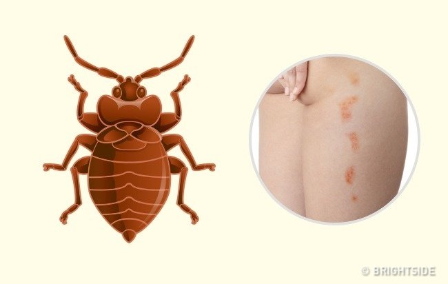 Picture 10 of Simple way to 'identify' an insect bite