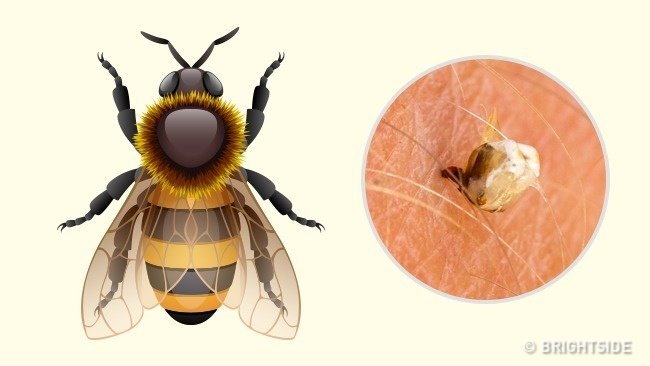 Picture 2 of Simple way to 'identify' an insect bite