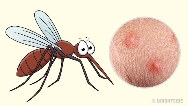 Picture 4 of Simple way to 'identify' an insect bite