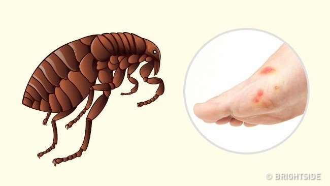 Picture 6 of Simple way to 'identify' an insect bite