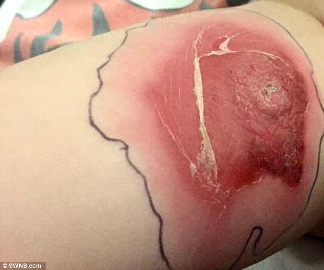 Picture 4 of 'Six-eyed monster' and venom cause people to burst into blood vessels