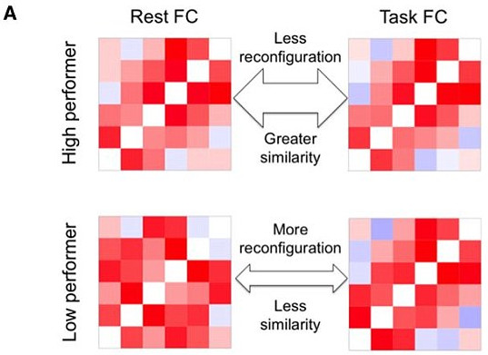 Picture 2 of Smart people have unusual brain waves