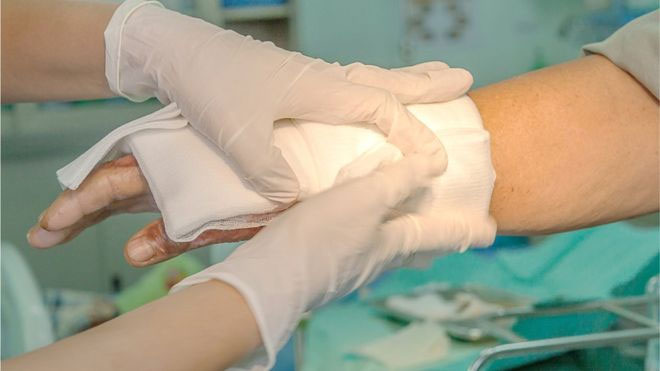 Picture 1 of Smart sensor knows 'hearing' healing wounds