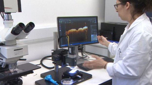 Picture 3 of Smart sensor knows 'hearing' healing wounds