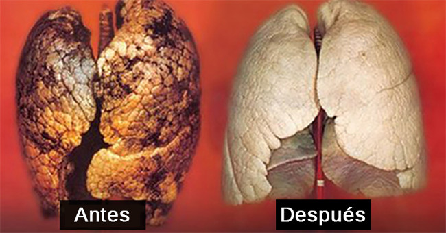 Picture 3 of Smoking for more than 5 years, follow these 5 ways to save your lungs
