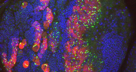 Picture 1 of 'Snake' exists ... in human cells