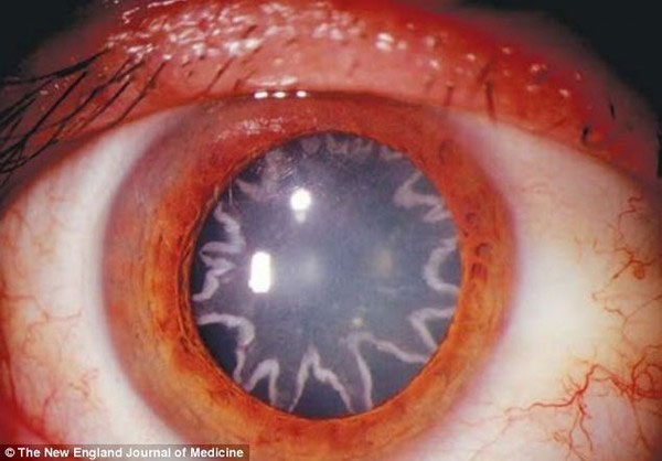 Picture 5 of Solution for the disease