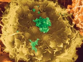 Picture 1 of Some viruses end up attacking each other