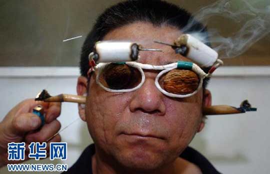 Picture 4 of Special acupuncture procedures of Chinese people