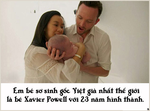 Picture 10 of Special births that no one can