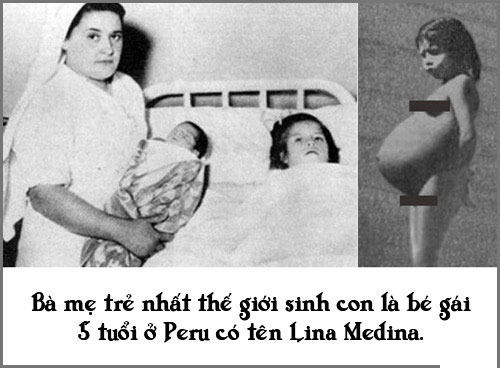 Picture 2 of Special births that no one can