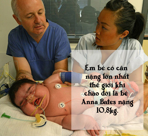 Picture 3 of Special births that no one can