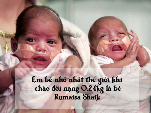 Picture 4 of Special births that no one can