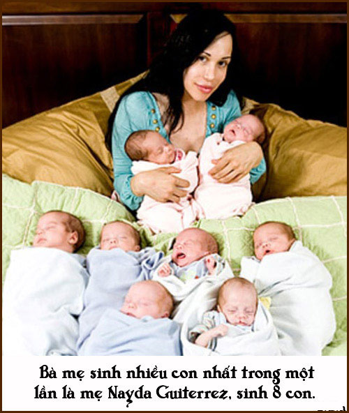 Picture 6 of Special births that no one can
