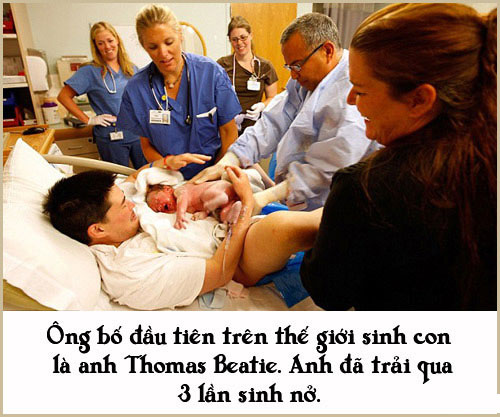 Picture 7 of Special births that no one can