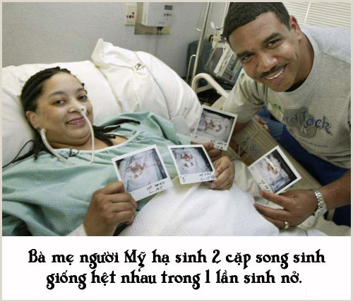 Picture 9 of Special births that no one can